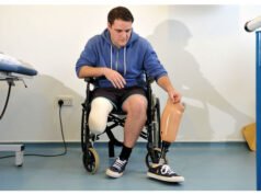 Fully Funded Scholarships For Amputees 2024/2025 Fully Funded Scholarships For Amputees